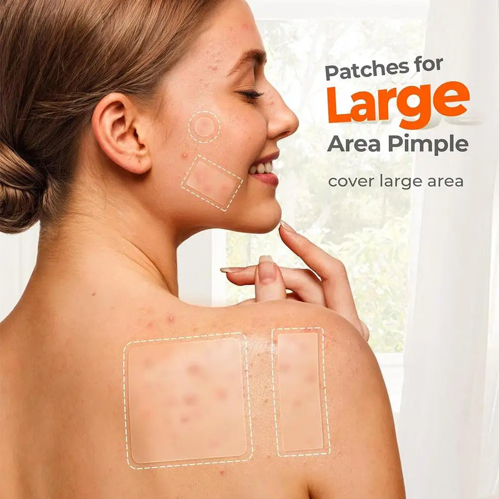 Hydrocolloid Pimple Patches – Mixed Sizes Invisible Acne Stickers Acne Pimple Patches Oasis Select