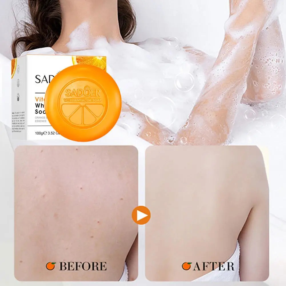 100g Vitamin C Brightening Soap, Hydrating Face & Body For Radiant Glow Skin, Nourishing, Moisturizing Bath Bar with Orange Peel Oasis Select