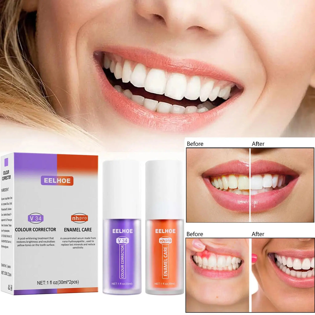 V34 Whitening Toothpaste 2-Pack | Stain Removal & Fresh Breath