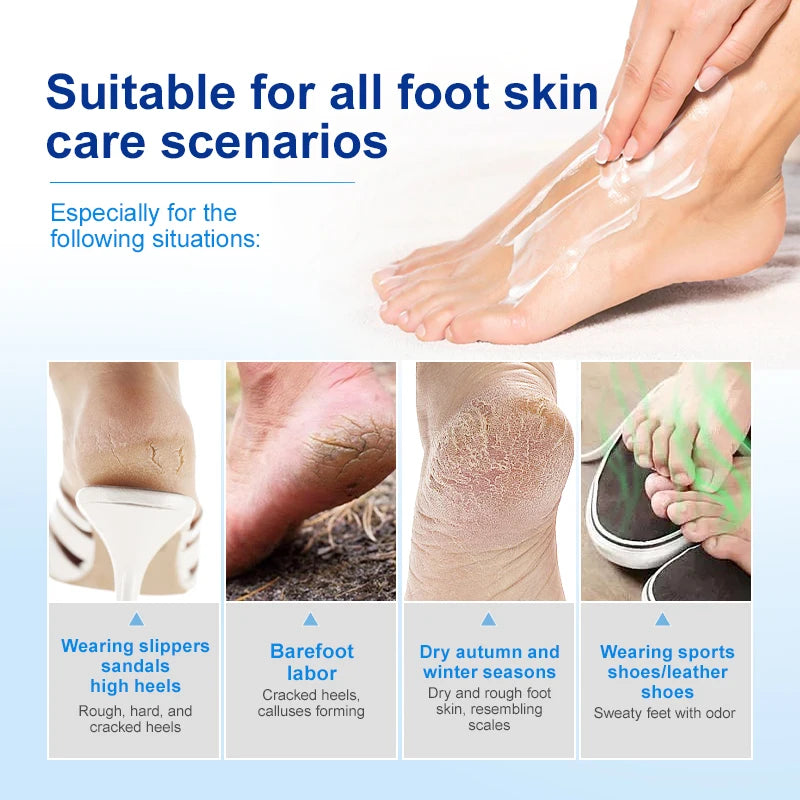 Urea Foot Cream Moisturizing Exfoliating Hand Feet Dead Skin Removal Anti Peeling Heels Repair Mask Foot Skin Care Products Oasis Select