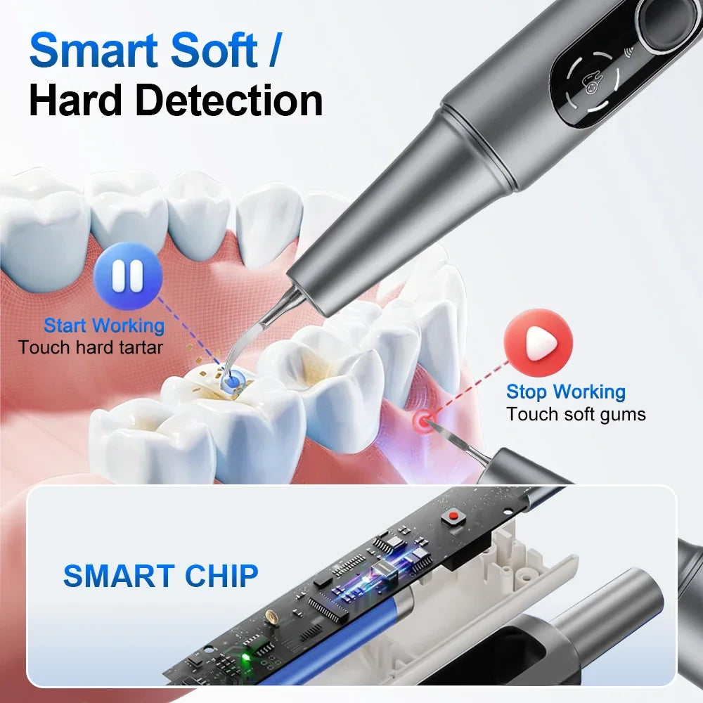 AFDEAL M1 Ultrasonic Teeth Cleaner – HD Camera & 5 Modes