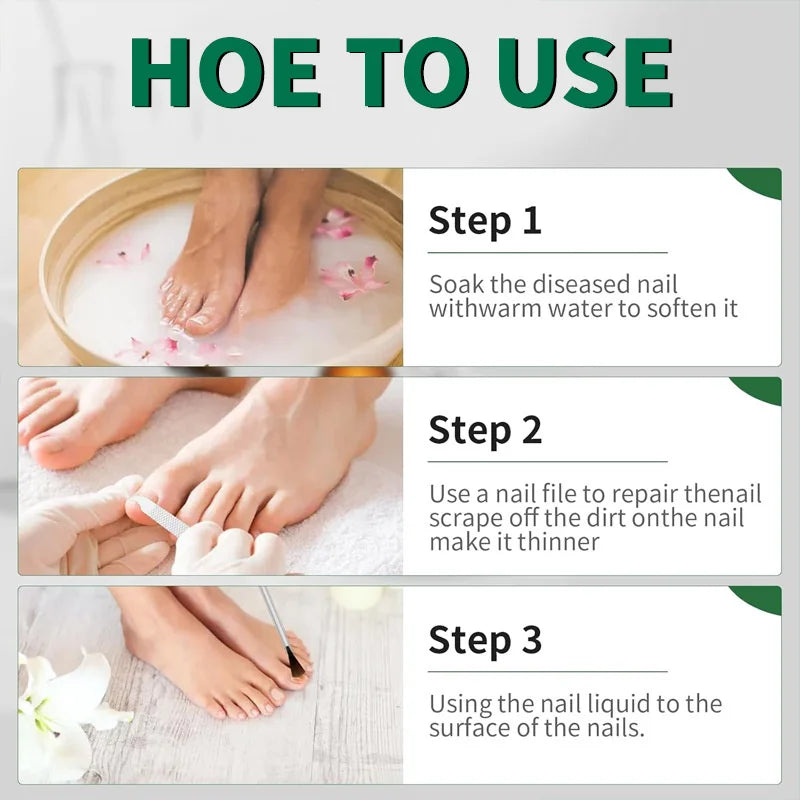 Eelhoe Nail Repair Serum – Ginger Extract for Healthy Nails Nail Repair Serum Oasis Select