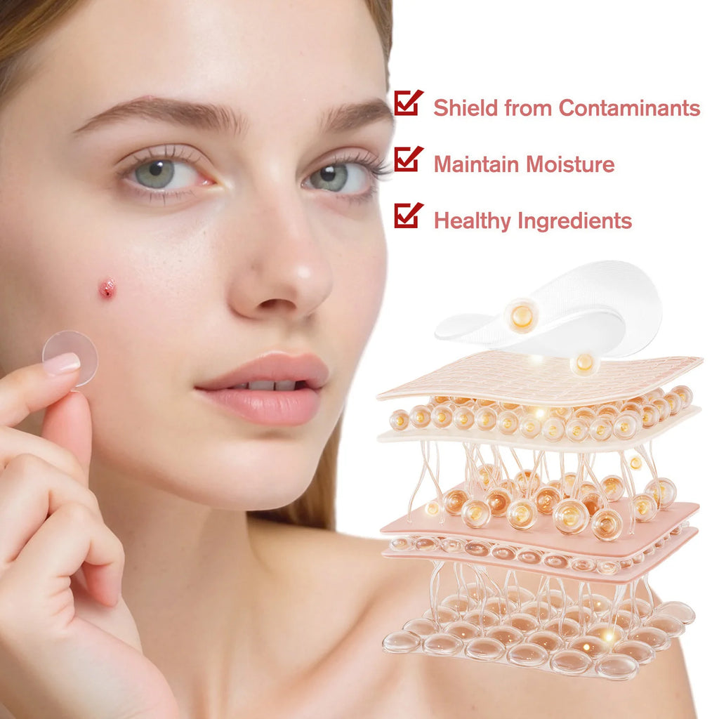 Hydrocolloid Acne Patches – 96-Count Invisible Spot Treatment Acne Spot Patches Oasis Select