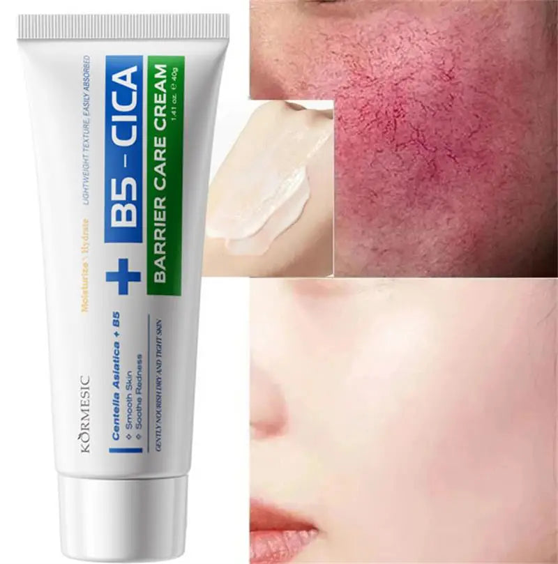 SADOER B5 Repair Cream – Vitamin B5 & Centella Moisturizer 40g Barrier Repair Cream Oasis Select 1pc