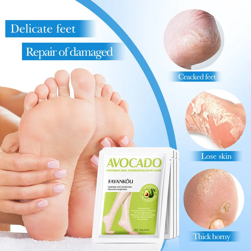 BIOAOUA Avocado Exfoliating Foot Mask 5 Pairs – Dead Skin Remover Exfoliating Foot Mask Oasis Select