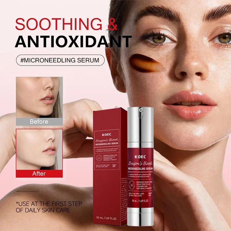 Centella Asiatica Microneedle Serum Deep Hydration Soothing Dragon Blood Serum Firm Brighten Repairing Facial Essence Oasis Select