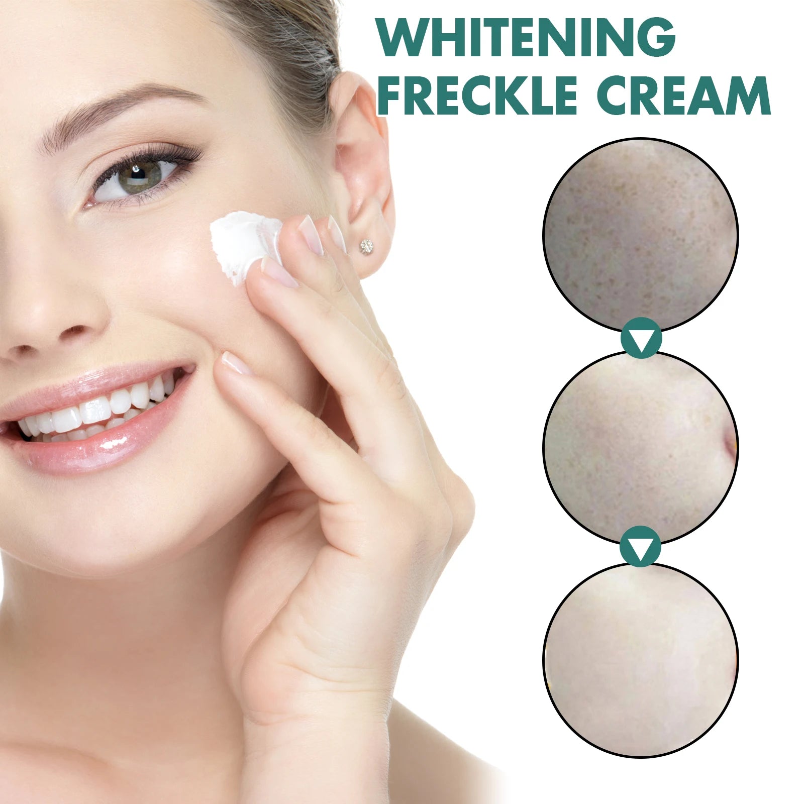 EELHOE Niacinamide Freckle & Melasma Removal Cream 30g