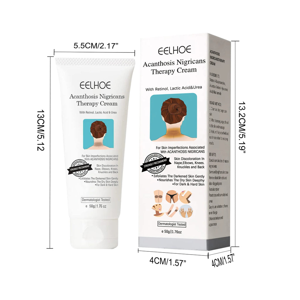 EELHOE Whitening Cream Brightening Skin For Dark Skin Neck Arm Knee Joint Underarm Body Care Acanthosis Nigricans Therapy Cream Oasis Select