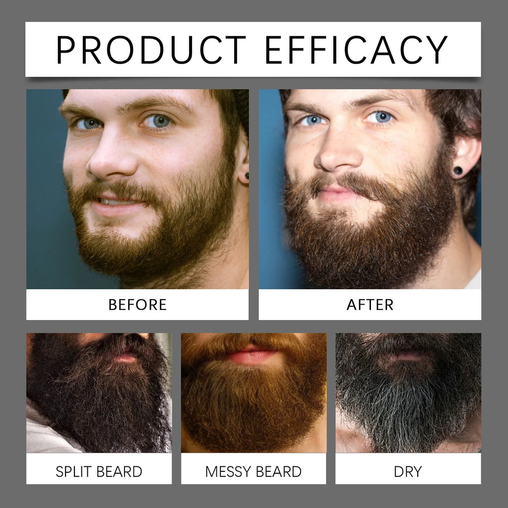 Beard Growth Oil Thickening Serum Promotes Whisker Growth Strengthen Roots Softens Beard Moisturizing Hydrating Men Grooming Oasis Select