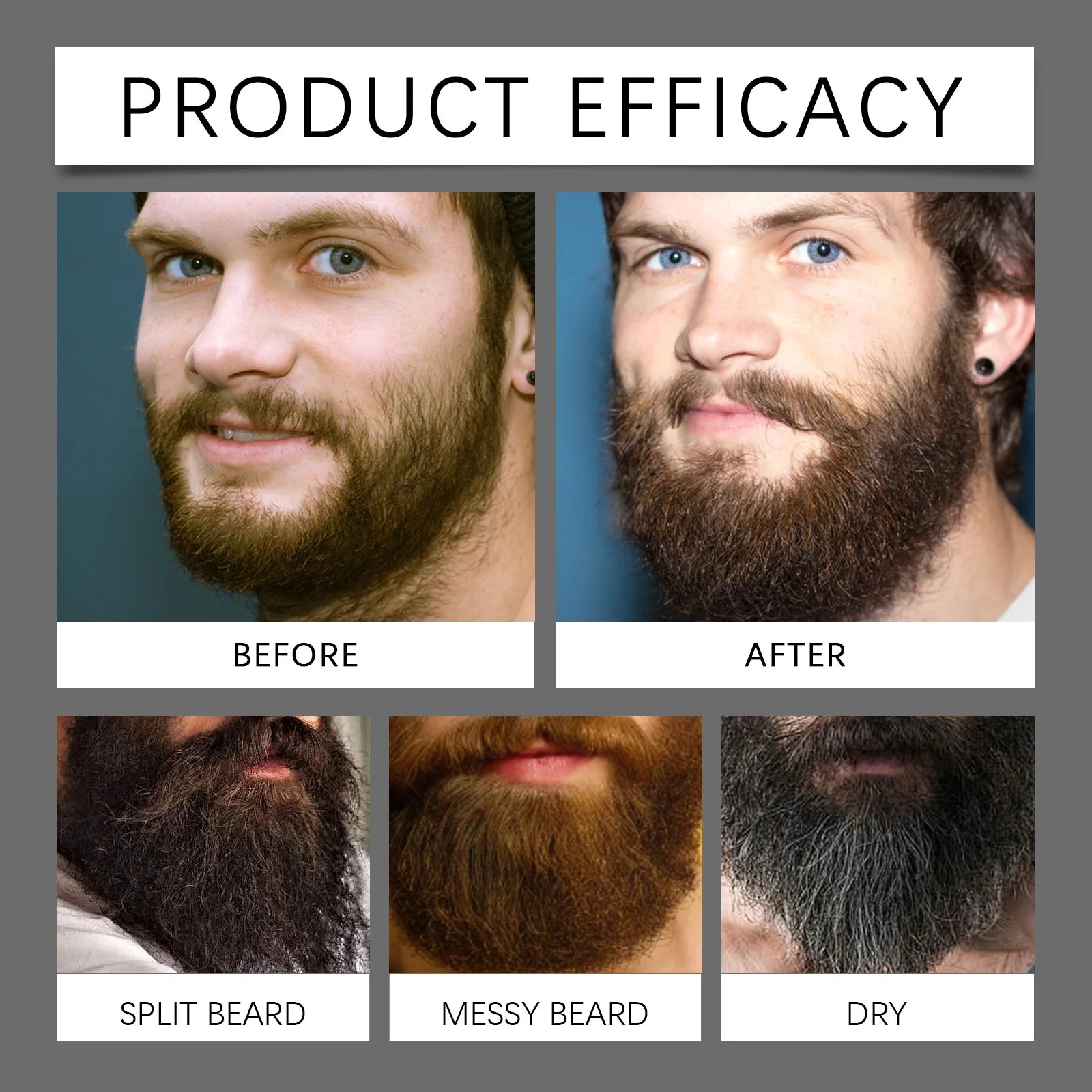 Beard Growth Oil Thickening Serum Promotes Whisker Growth Strengthen Roots Softens Beard Moisturizing Hydrating Men Grooming Oasis Select