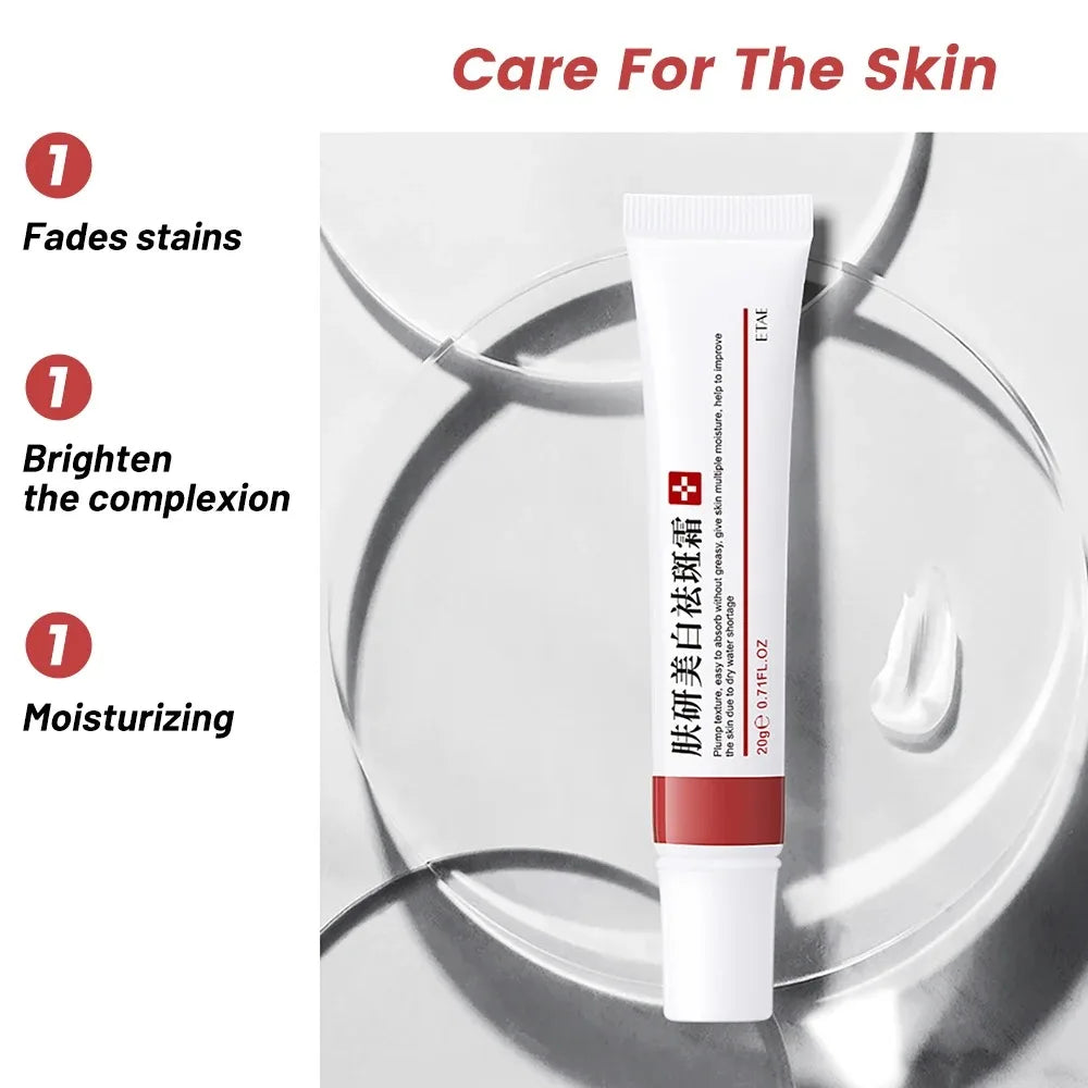 20g Whitening Freckle Cream Remove Dark Spot Cream Anti Freckle and Aging Cream Fade Pigmentation Melasma Brighten Serum Skin Oasis Select