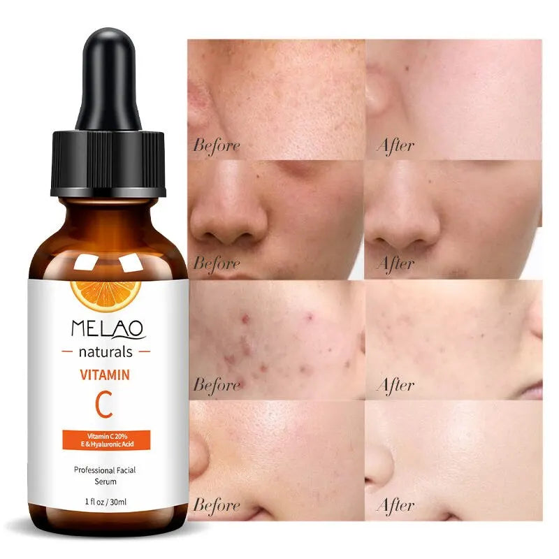 MELAO Vitamin C Face Serum 30ml | Brightening & Hyaluronic Acid