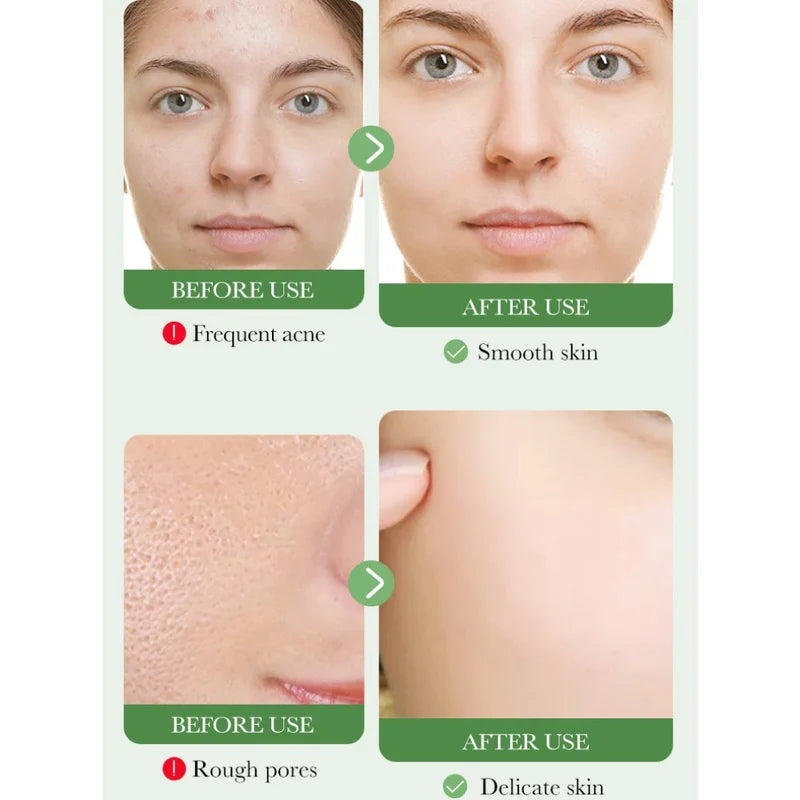 BIOAOUA Nourishing Centella Asiatica Facial Cleanser for Deep Pore Cleansing and Soothing Skin Care 100g Oasis Select