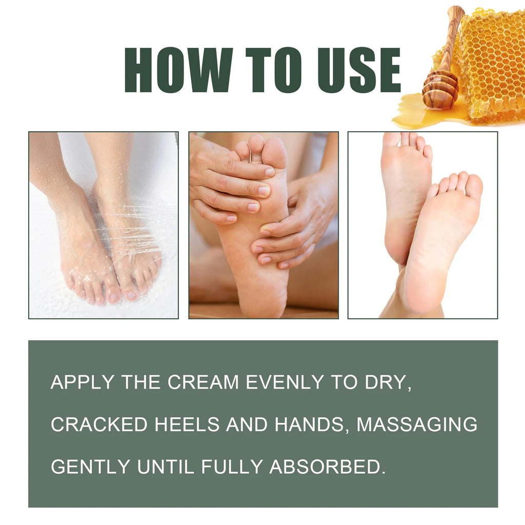 WOODSLEEP Cracked Heel & Hand Repair Cream – Deep Moisturizer Foot & Hand Cream Oasis Select