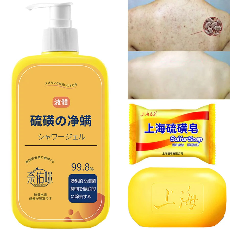 400ml Sulfur Shower Gel – Oil Control & Pore Cleansing Wash