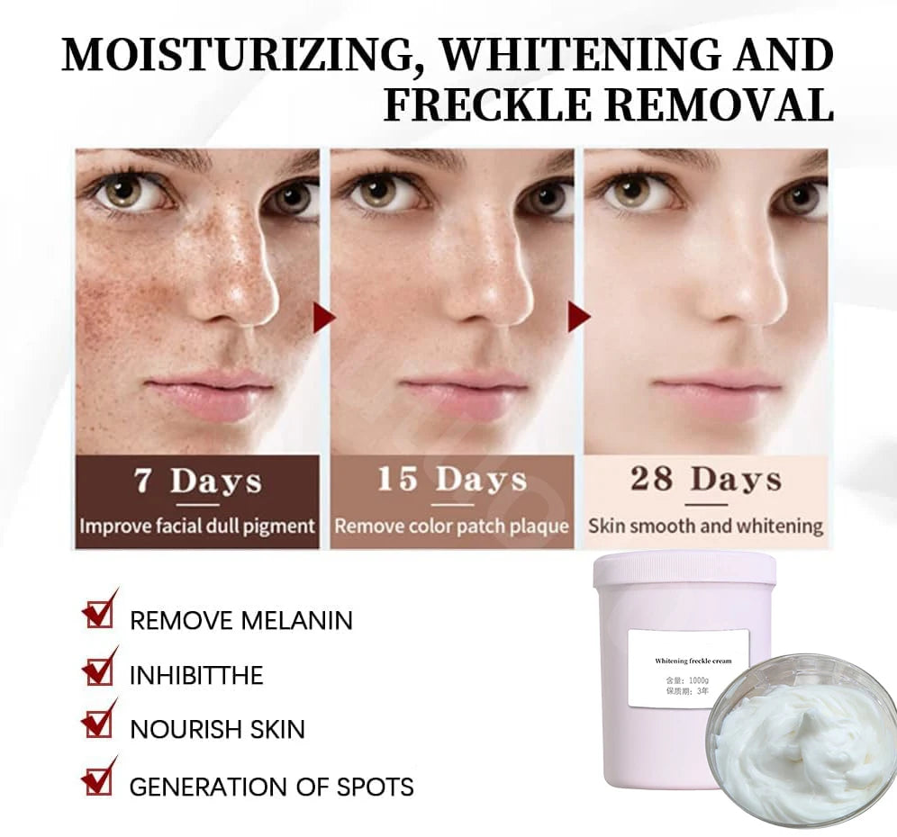Original Whitening Freckles Face Cream Corrector Fade Dark Spots Melasma Inhibit Melanin Lighten Skin Hydrating Beauty Skincare Oasis Select