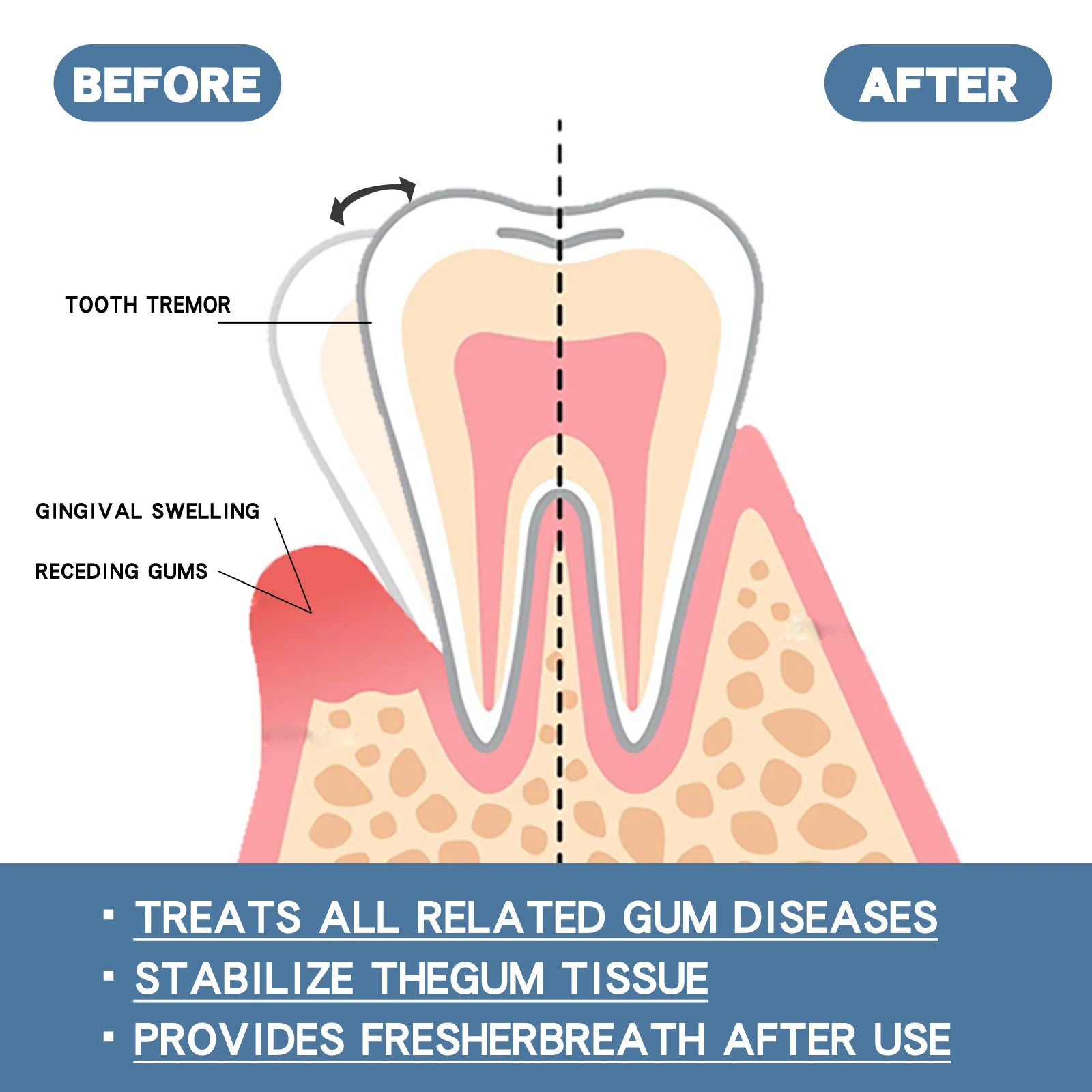 Gum Protect Repair Drops Strengthens Gum Attachment Relieves Oral Discomfort Oral Care For Teeth Brightening Serum Oasis Select