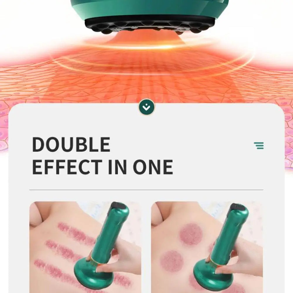 Rechargeable Cellulite Cupping Massager – Body Sculpting Tool Body Cupping Massager Oasis Select