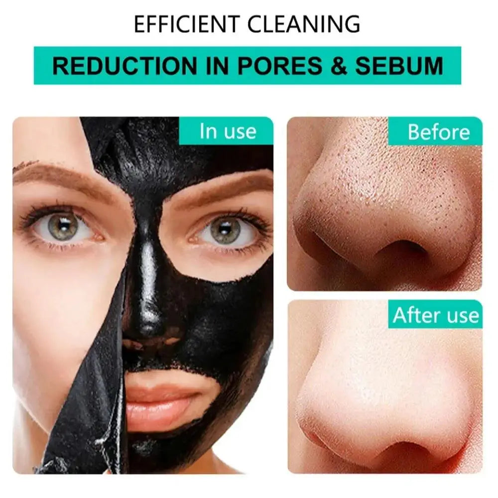 Peel-Off Blackhead Mask – Deep Cleanse, Oil Control 120g
