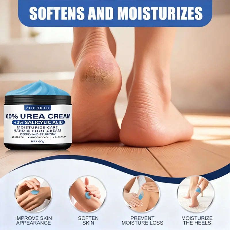 YUITIKUE 60% Urea Foot Cream – Dry Heel Repair 60g