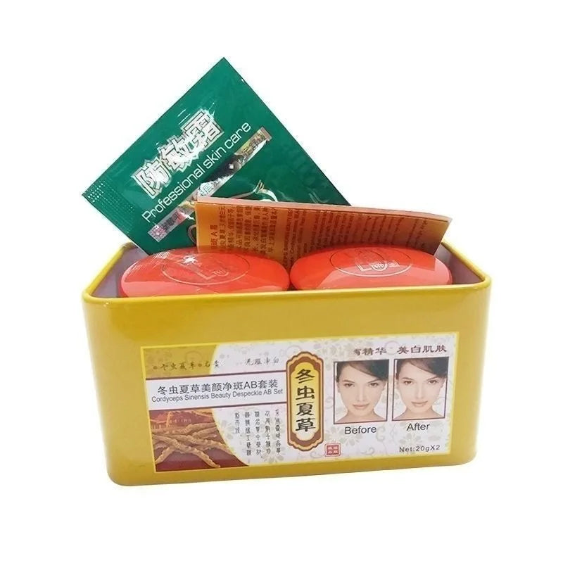 Original Chinese Aweto Whitening Anti-Acne Day Night Cream Set Melasma Dark Age Spots Freckle Remover Skin Lightening Skin Care Oasis Select