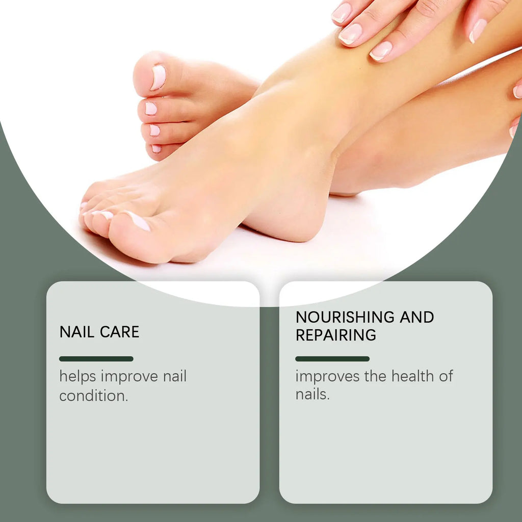 7 Days Nail Strengthening Oil Nail Fungus Treatment Repairing Paronychia Ingrown Toenail Onychomycosis Removal Care Product 30ml Oasis Select