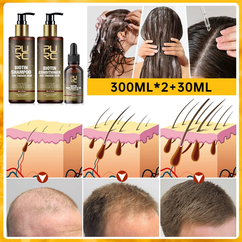 Biotin Prevent Hair Loss Shampoo And Conditioner Growth Oil Treatment For Hair Fast Regrowth Care Beard Hair Beauty Health Care Oasis Select