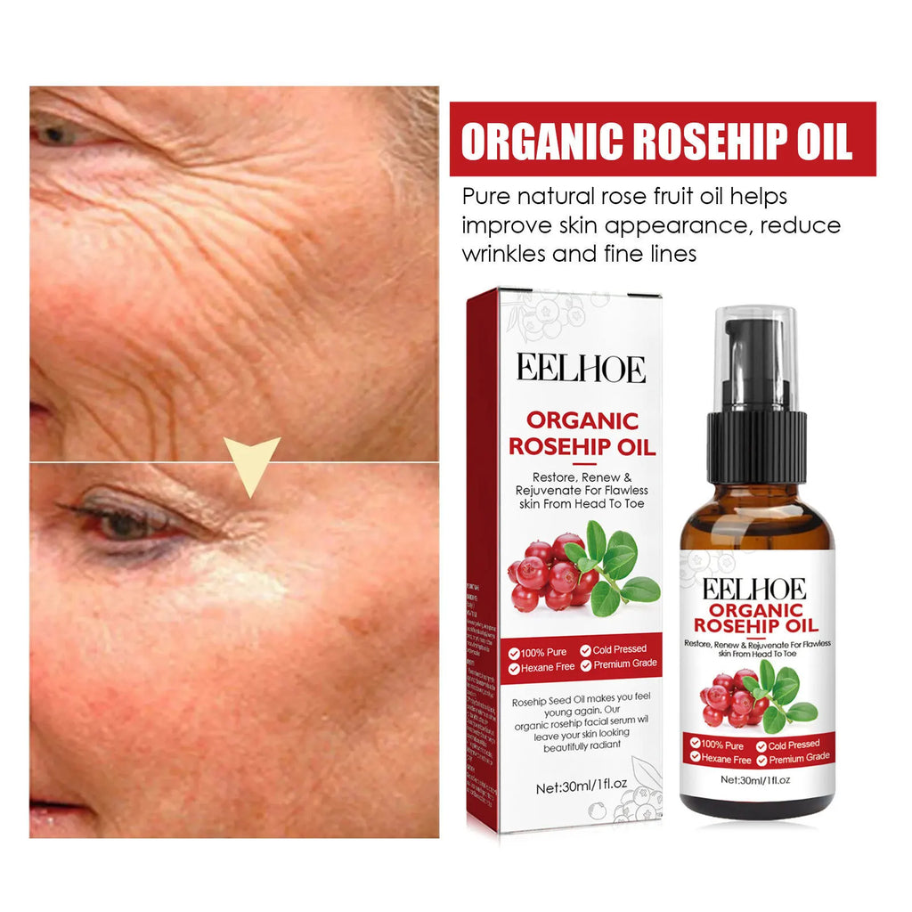 30ml Rosehip Oil Facial Serum Moisturizing and Fading Wrinkles Organic Face Serum Fine Pore Anti-aging Essential Oil Oasis Select