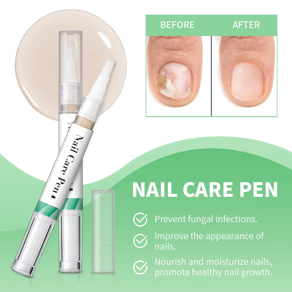 Nail Growth Cuticle Oil Pen – 2-Pack Nail Treatment | ibcccndc Nail Treatment Oil Oasis Select