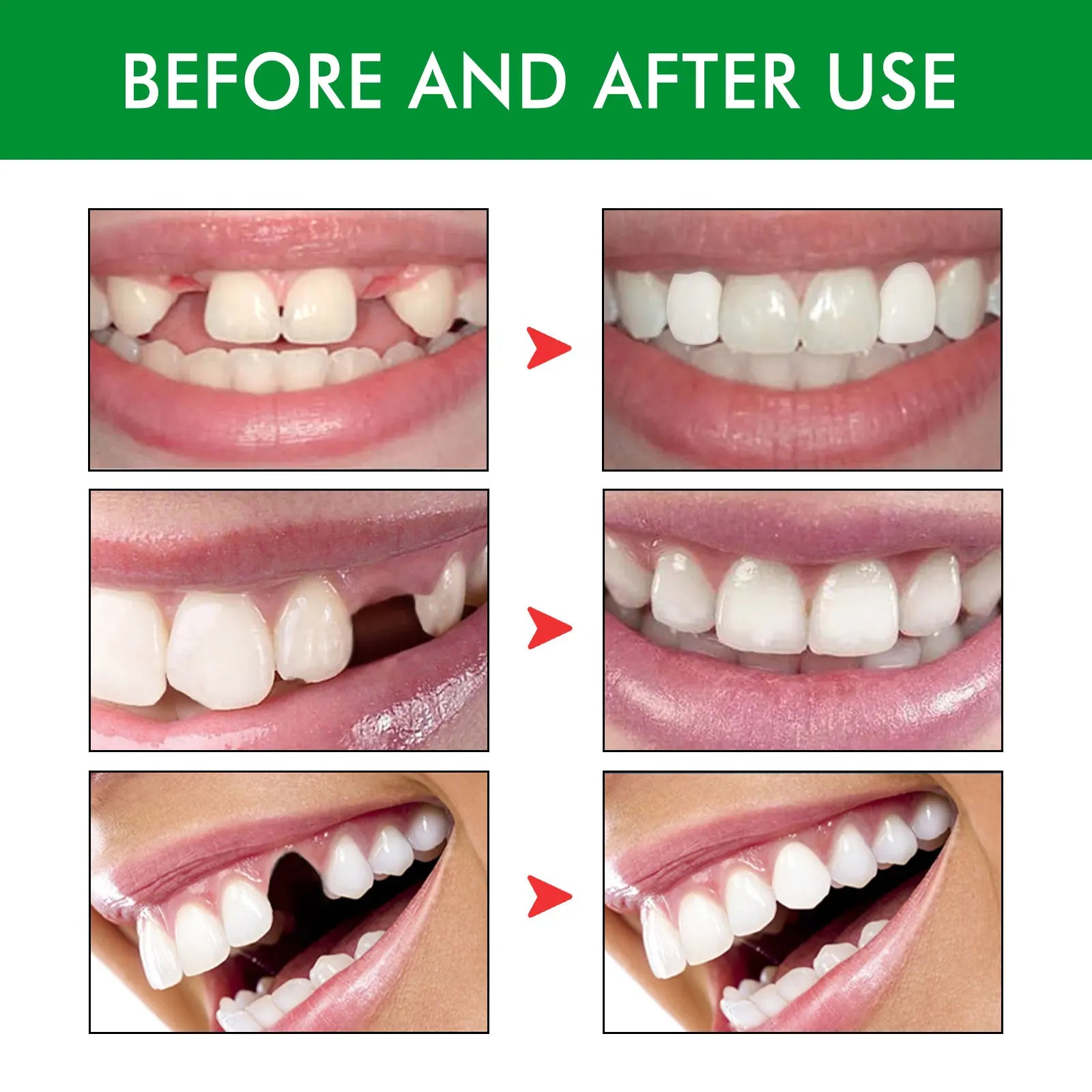 Temporary Tooth Kit, Moldable Dental Gel for Film & Ball Cosplay, Temporary Teeth Repair & Natural Dental Gap Filling Oasis Select