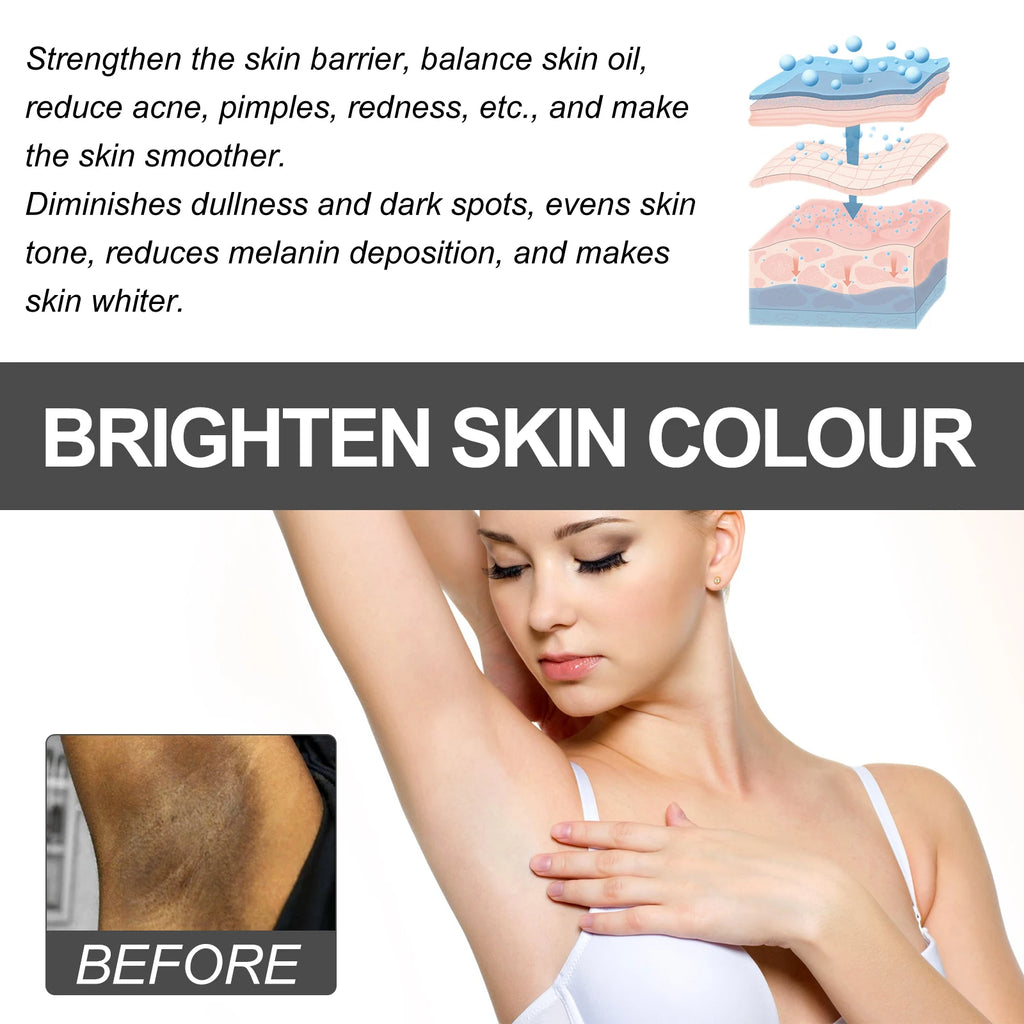 Dark Spot Brightening Cream – Underarms, Thighs & Joints Skin Brightening Cream Oasis Select