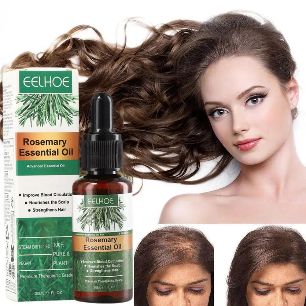 Eelhoe Rosemary Oil for Hair Growth & Repair – 30ml