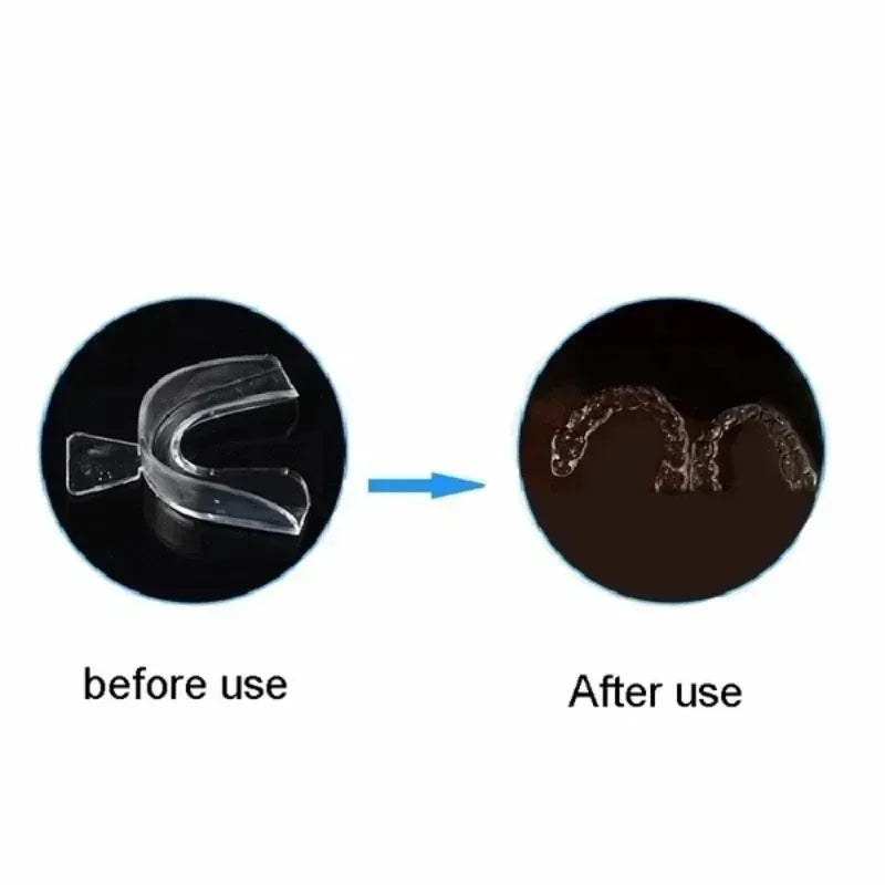 1-10Pcs Anti Snoring Bruxism Sleeping Mouth Guard Night Guard Gum Shield Mouth Tray Stop Teeth Grinding Sleep Aid Health Care Oasis Select