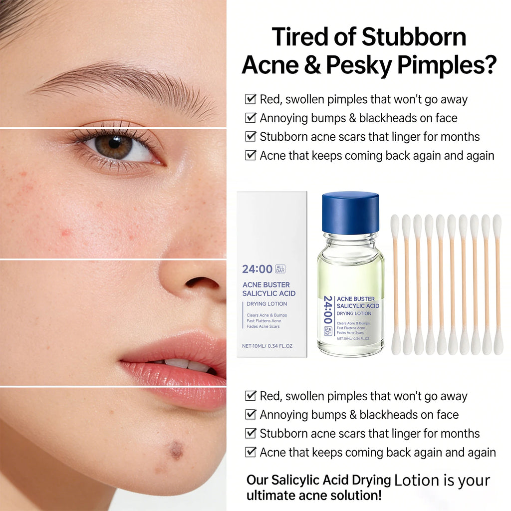 Salicylic Acid Drying Lotion Serum – Clear Pores & Fade Marks