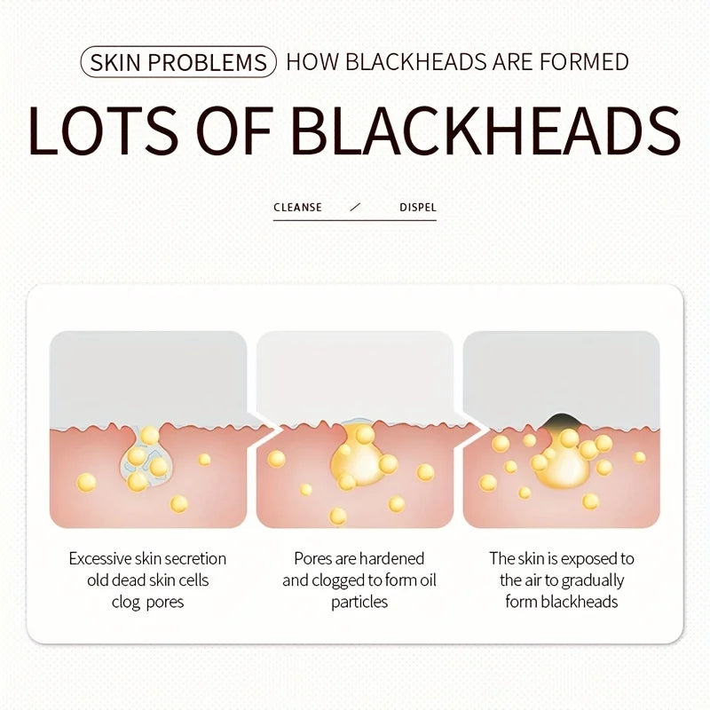 Three-Step Blackhead Removal Nose Patch Softens and Cleans Blackheads, Refines Pores, Nose Mask Patch Oasis Select