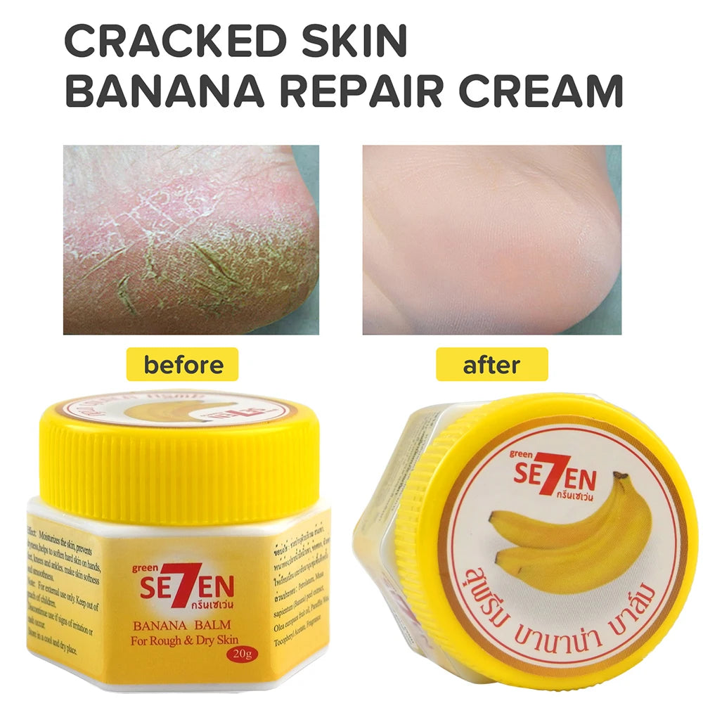 Banana Extract Foot Cream – Overnight Cracked Heel Renewal 20g Foot Cream Oasis Select