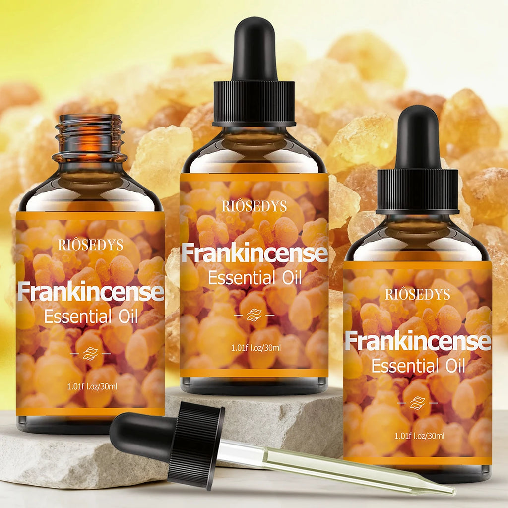 Frankincense Essential Oil – Massage, Hair Care & Diffuser
