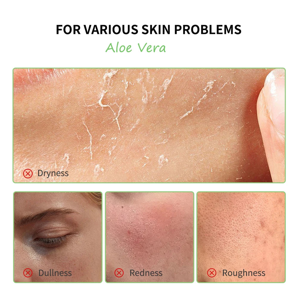 Aloe Vera Extract Skin Care Lightening Moisturizing Soothing Natural Organic Aloe Vera Gel Reduce Redness Hydrate Exfoliation Oasis Select