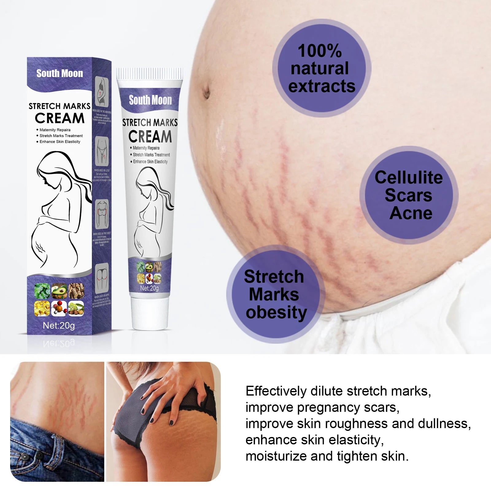Remove Pregnancy Stretch Marks Cream Improves Elasticity Fade Growth Lines Smoothing Nourishing Moisturizing Firming Skin Care Oasis Select