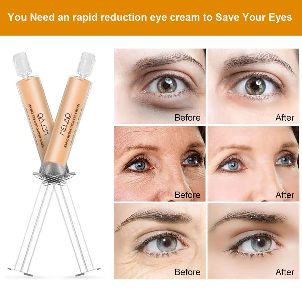 MELAO Rapid Reduction Eye Cream – Dark Circles & Wrinkles