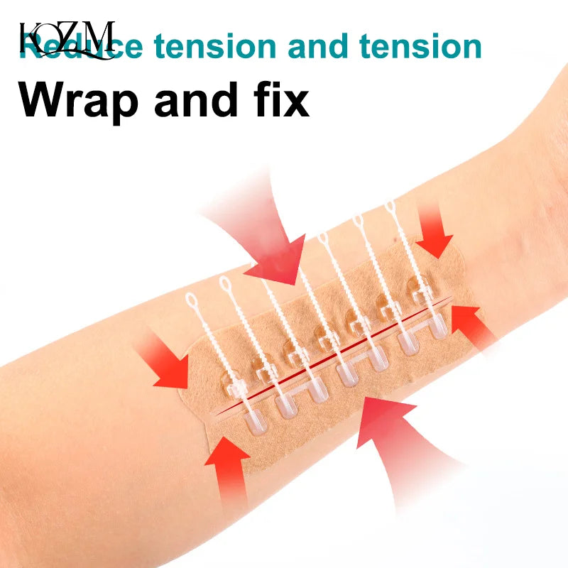 Zipper Wound Closure Patch – Hemostatic No-Suture Bandage