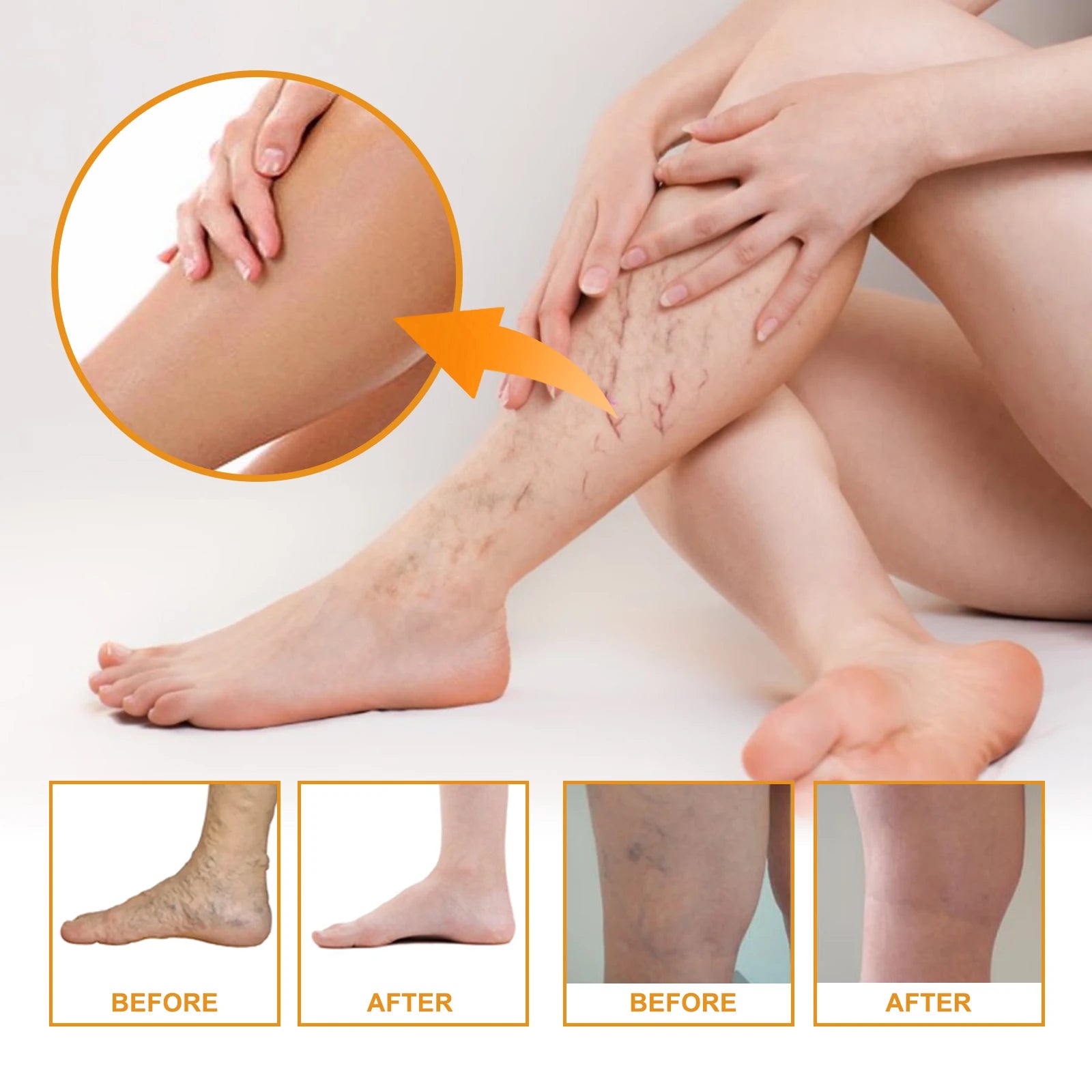 Vitamin K Leg Massage & Skin Care Cream 60g – Daily Moisturiser Body Massage Cream Oasis Select