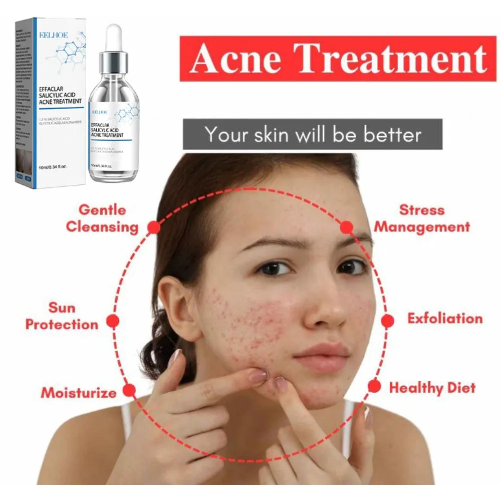 Eelhoe Salicylic Acid Face Serum – Pore Minimizer & Oil Control