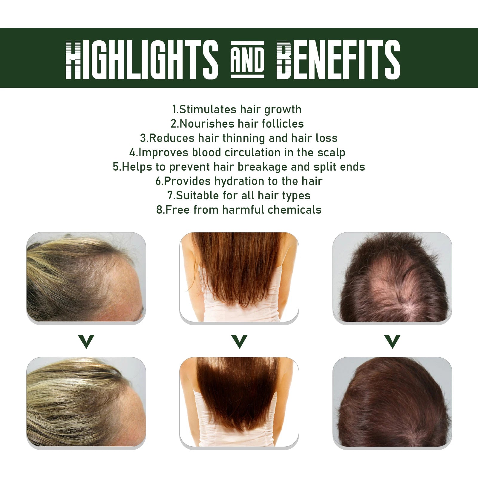 EELHOE Ginger Hair Spray – Prevent Hair Loss & Thicken Hair