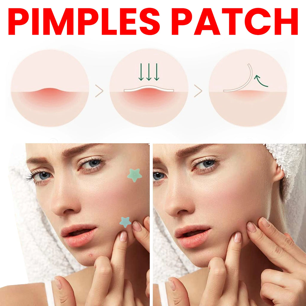 200Pcs Repair Acne Patch Fade Blemishes Pimple Marks Closed Acne Blemishes Hydrocolloid Star Shaped Cover Acne Pimple Patch Oasis Select