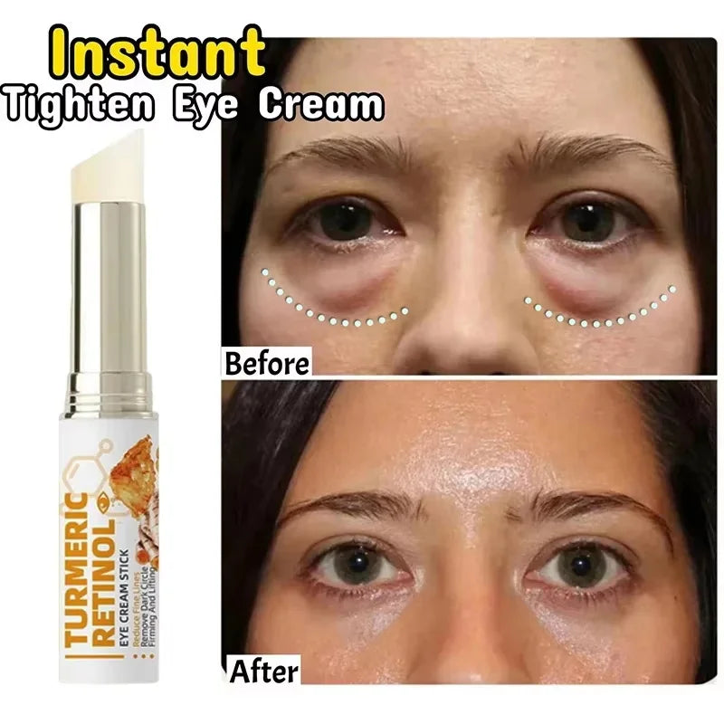 SADOER Retinol Eye Cream – Brighten, Firm & Hydrate Eye Cream Oasis Select