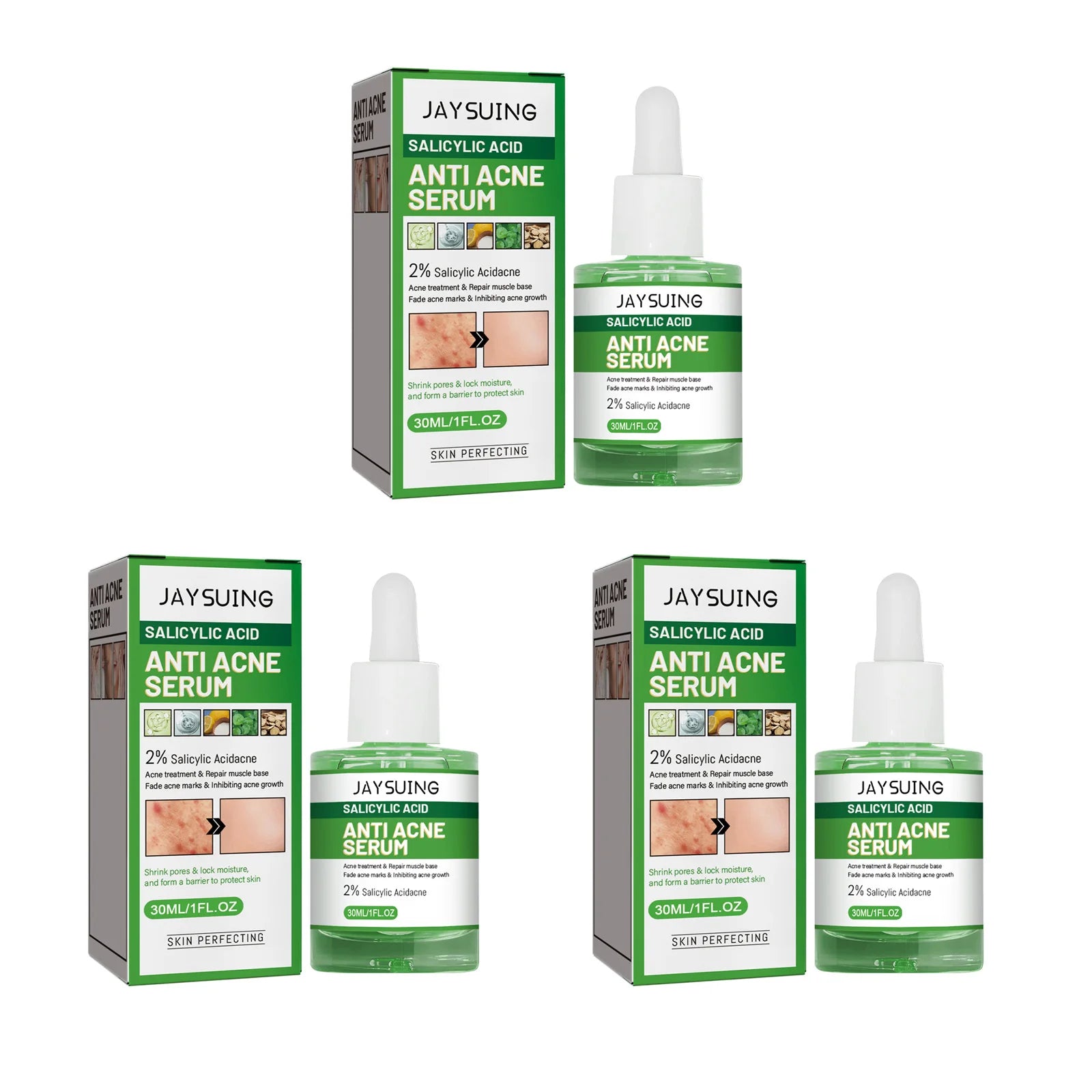 Salicylic Acid Anti Acn-e Face Serum Hydrating Fader Acne Mark Pimple Blackhead Removal Shrink Pores Oil Control Facial Essence Oasis Select 3 x 30ml Boxed