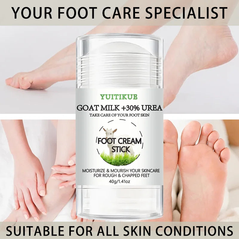 YUITIKUE 30% Urea & Goat Milk Foot Cream Stick – Dry Feet