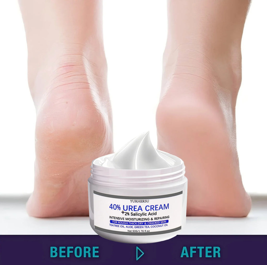 YURHERSU 40% Foot Cream – Exfoliating Dry & Cracked Heels Foot Care Cream Oasis Select WHITE 150g