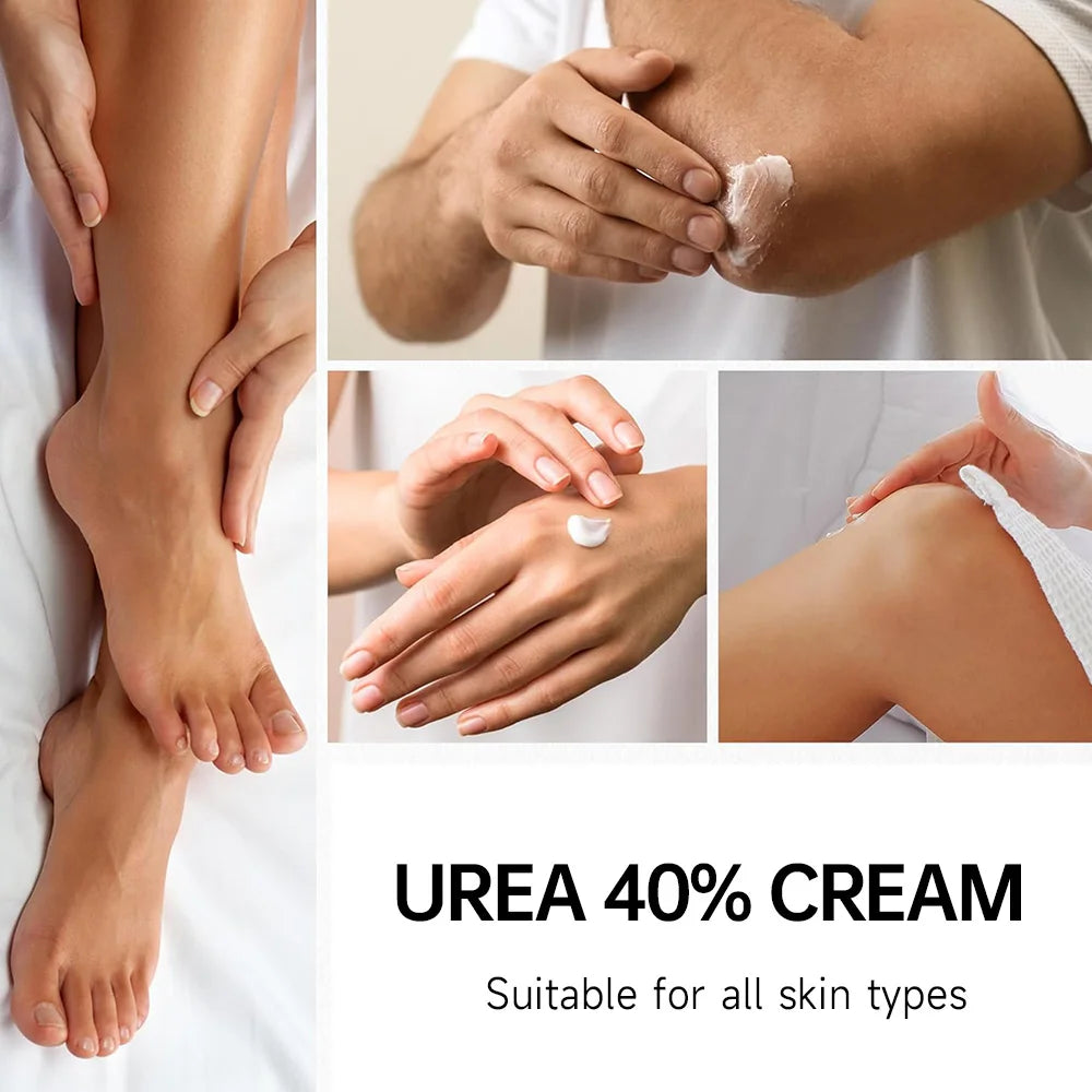 40% Urea Foot Cream + 2% Salicylic Acid | Callus & Heel Care